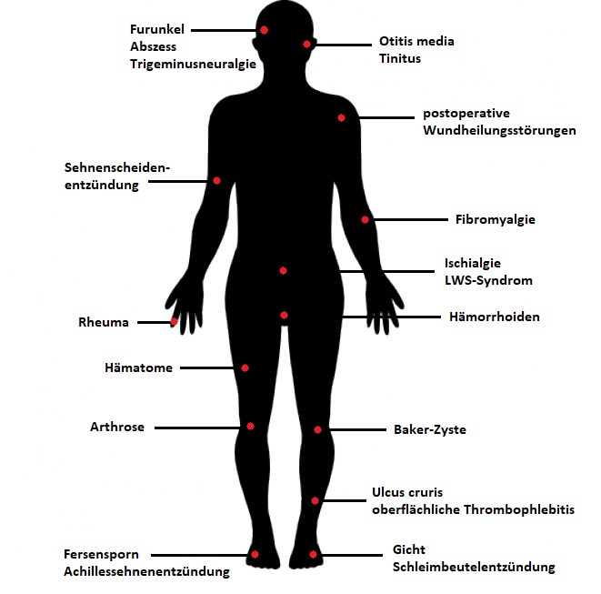Mensch Indikationen allergie, naturheilpraxis, naturheilpraktiker, bioresonanz